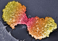 胰腺癌细胞