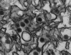 寨卡病毒的电子显微照片。源疾病预防控制中心