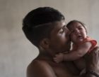 美联社图片，一个出生时患有小头症的孩子