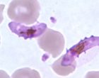 薄血涂片中的恶性疟原虫配子细胞