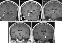 大脑MRI随着时间的推移扫描信用Nagui Antoun