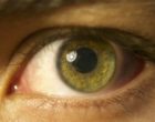 视网膜炎症可能成为癫痫发作负担的生物标志物吗？